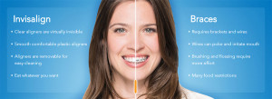 Invisalign results Perth dentist
