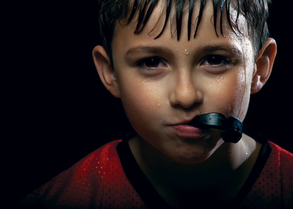 Custom mouthguards dentist Claremont