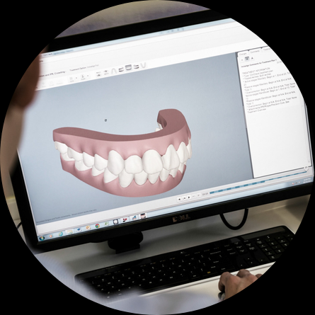 invisalign