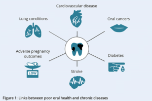 teeth killing you Perth dentist Claremont dental