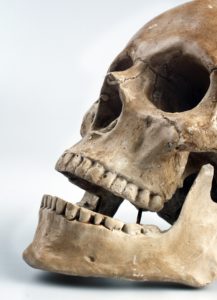 teeth killing you Perth dentist Claremont dental