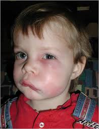 tooth decay children parents dentist Perth Claremont dental