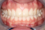 Dentist Claremont Cosmetic Dentist Perth Claremont Dental