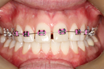 Dentist Claremont Cosmetic Dentist Perth Claremont Dental
