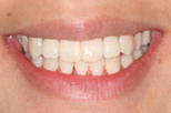 Dentist Claremont Cosmetic Dentist Perth Claremont Dental