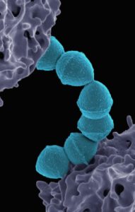 how to get a healthy oral microbiome claremont dentist Perth cosmetic dentistry Claremont dental
