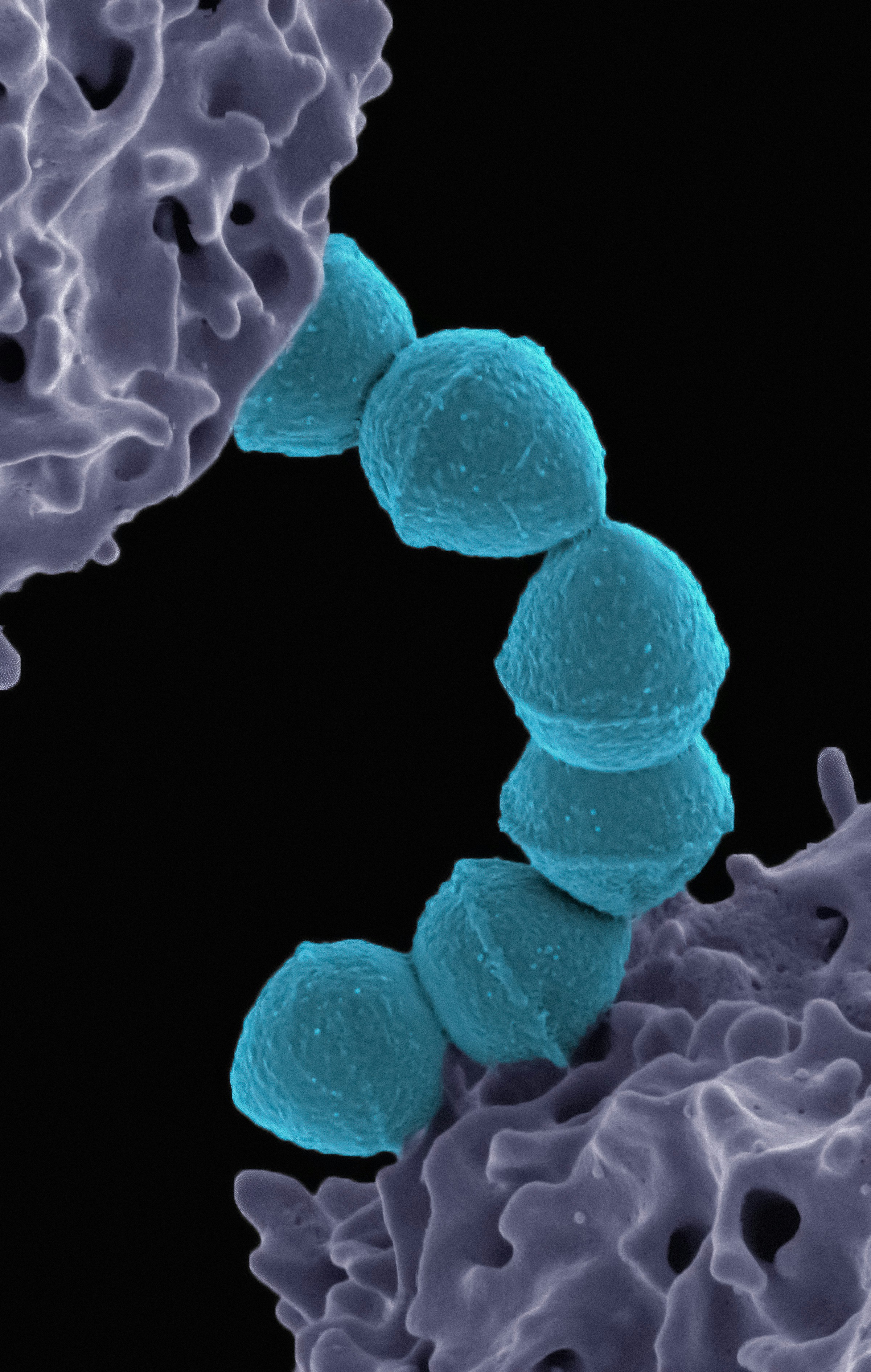 how to get a healthy oral microbiome claremont dentist Perth cosmetic dentistry Claremont dental