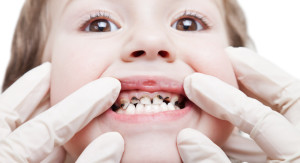 cavities in children