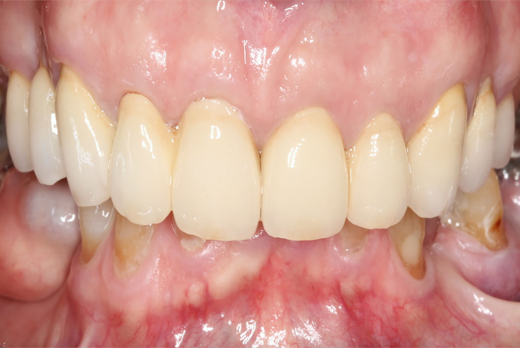 richard after Dentist Claremont Cosmetic Dentist Perth Claremont Dental