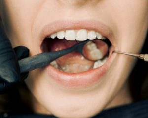 top 3 tips on dental insurance Claremont dental cosmetic dentistry Perth